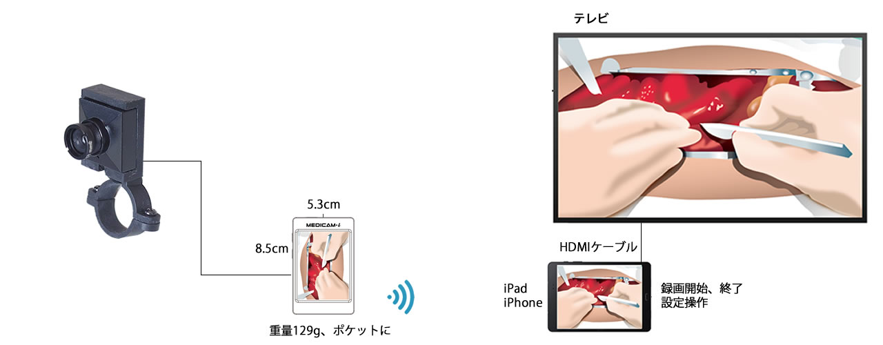 術野カメラ WiFiでiPadに