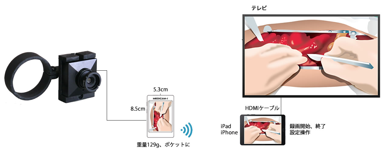 術野カメラ WiFiでiPadに